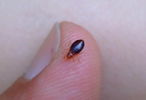 Bed Bug Bites: What The Pictures Show