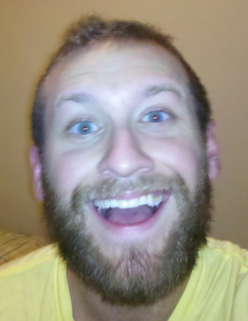 zach galifianakis beard. Zach Galifianakis#39; eard,
