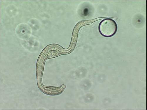  microscopic nematodes to characterize Gulf recovery. By Christi Fish