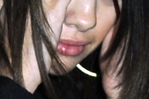 selena gomez punched lip. Selena Gomez | So apparently