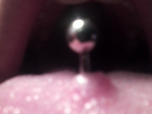 White Bump On Bottom Of Tongue Ring