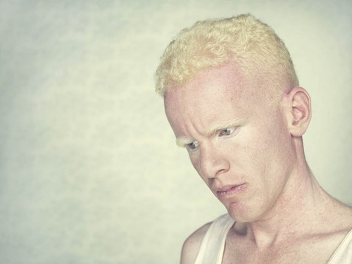 Albino person homemade fuck