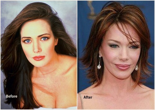Sharon tay before and after plastic surgery