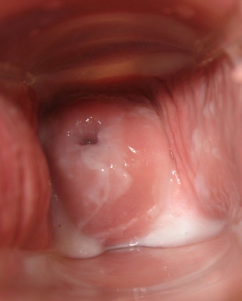 Creamy Vaginal Discharge Cumception